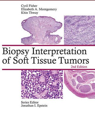 خرید و دانلود نسخه کامل کتاب Biopsy Interpretation of Soft Tissue Tumors