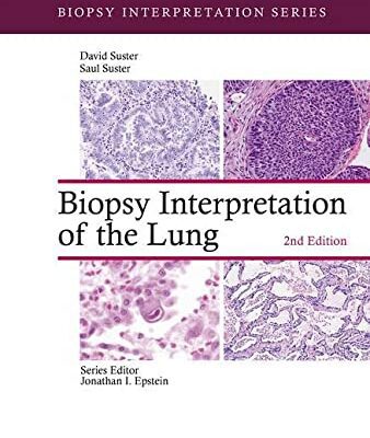 خرید و دانلود نسخه کامل کتاب Biopsy Interpretation of the Lung