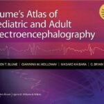 خرید و دانلود نسخه کامل کتاب Blume’s Atlas of Pediatric and Adult Electroencephalography