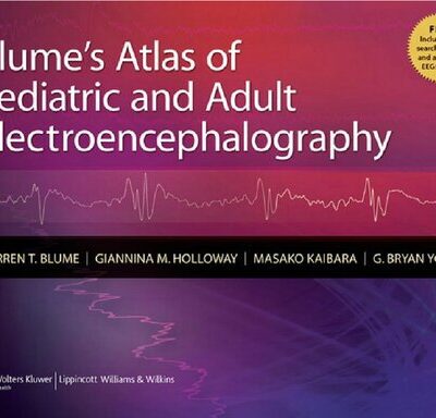 خرید و دانلود نسخه کامل کتاب Blume’s Atlas of Pediatric and Adult Electroencephalography