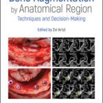 خرید و دانلود نسخه کامل کتاب Bone Augmentation by Anatomical Region: Techniques and Decision-Making