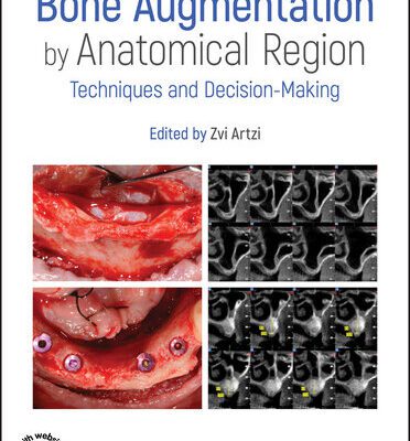 خرید و دانلود نسخه کامل کتاب Bone Augmentation by Anatomical Region: Techniques and Decision-Making