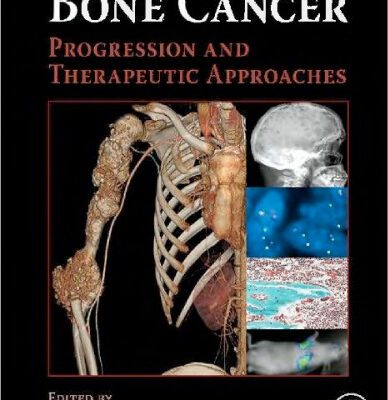 خرید و دانلود نسخه کامل کتاب Bone Cancer: Progression and Therapeutic Approaches