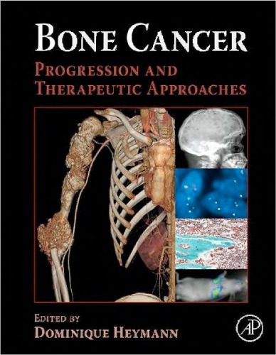 خرید و دانلود نسخه کامل کتاب Bone Cancer: Progression and Therapeutic Approaches_68bb52efe05c0.jpeg خرید و دانلود نسخه کامل کتاب Bone Cancer: Progression and Therapeutic Approaches