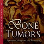 خرید و دانلود نسخه کامل کتاب Bone tumours: symptoms, diagnosis, treatment