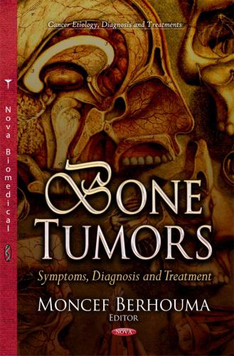 خرید و دانلود نسخه کامل کتاب Bone tumours: symptoms, diagnosis, treatment_68bb40e2c6179.jpeg خرید و دانلود نسخه کامل کتاب Bone tumours: symptoms, diagnosis, treatment