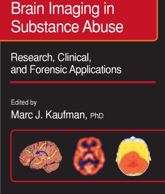 خرید و دانلود نسخه کامل کتاب Brain Imaging in Substance Abuse. Research, Clinical and Forensic Applns