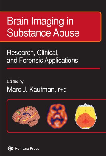 خرید و دانلود نسخه کامل کتاب Brain Imaging in Substance Abuse. Research, Clinical and Forensic Applns_68bae7ff6ea0a.jpeg خرید و دانلود نسخه کامل کتاب Brain Imaging in Substance Abuse. Research, Clinical and Forensic Applns