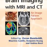 خرید و دانلود نسخه کامل کتاب Brain Imaging with MRI and CT: An Image Pattern Approach
