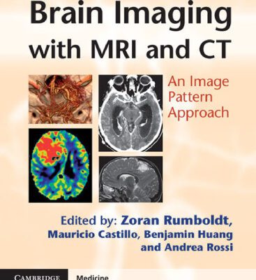 خرید و دانلود نسخه کامل کتاب Brain Imaging with MRI and CT: An Image Pattern Approach