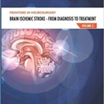 خرید و دانلود نسخه کامل کتاب Brain Ischemic Stroke Brain Ischemic Stroke – From Diagnosis to Treatment (Frontiers in Neurosurgery)