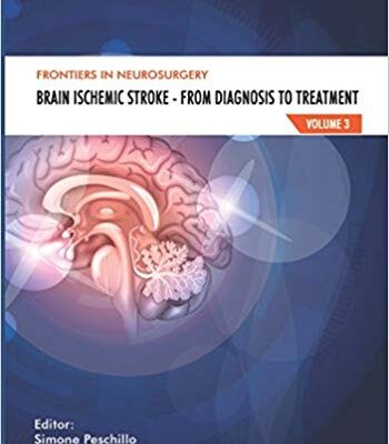 خرید و دانلود نسخه کامل کتاب Brain Ischemic Stroke Brain Ischemic Stroke – From Diagnosis to Treatment (Frontiers in Neurosurgery)
