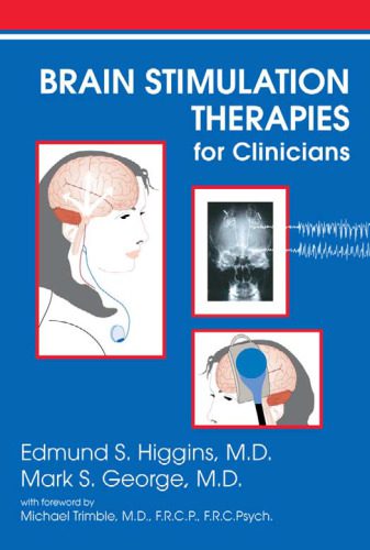 خرید و دانلود نسخه کامل کتاب Brain Stimulation Therapies for the Clinician_68bb50d75eb12.jpeg خرید و دانلود نسخه کامل کتاب Brain Stimulation Therapies for the Clinician