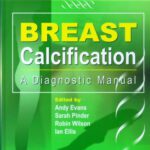 خرید و دانلود نسخه کامل کتاب Breast Calcification- A Diagnostic Manual