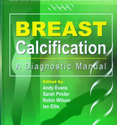 خرید و دانلود نسخه کامل کتاب Breast Calcification- A Diagnostic Manual
