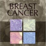 خرید و دانلود نسخه کامل کتاب Breast Cancer (2nd Edition)