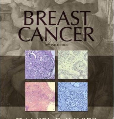 خرید و دانلود نسخه کامل کتاب Breast Cancer (2nd Edition)