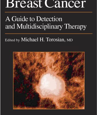خرید و دانلود نسخه کامل کتاب Breast Cancer: A Guide to Detection and Multidisciplinary Therapy (Current Clinical Oncology)