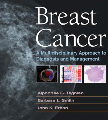 خرید و دانلود نسخه کامل کتاب Breast Cancer: A Multidisciplinary Approach to Diagnosis and Managmenet (Current Multidisciplinary Oncology Series)