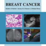 خرید و دانلود نسخه کامل کتاب Breast Cancer: An Atlas of Investigation and Management (Atlases of Investigation and Management)