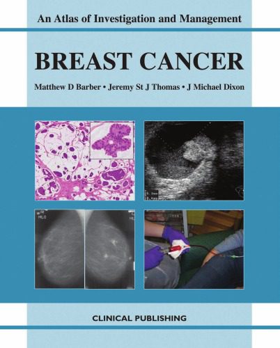 خرید و دانلود نسخه کامل کتاب Breast Cancer: An Atlas of Investigation and Management (Atlases of Investigation and Management)_68bb52abc3f45.jpeg خرید و دانلود نسخه کامل کتاب Breast Cancer: An Atlas of Investigation and Management (Atlases of Investigation and Management)
