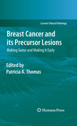 خرید و دانلود نسخه کامل کتاب Breast Cancer and its Precursor Lesions: Making Sense and Making It Early_68bb4915928f5.jpeg خرید و دانلود نسخه کامل کتاب Breast Cancer and its Precursor Lesions: Making Sense and Making It Early