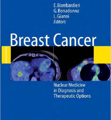 خرید و دانلود نسخه کامل کتاب Breast Cancer: Nuclear Medicine in Diagnosis and Therapeutic Options
