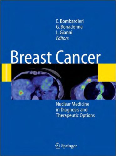 خرید و دانلود نسخه کامل کتاب Breast Cancer: Nuclear Medicine in Diagnosis and Therapeutic Options_68bb51a272e81.jpeg خرید و دانلود نسخه کامل کتاب Breast Cancer: Nuclear Medicine in Diagnosis and Therapeutic Options