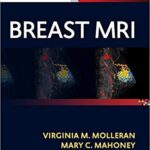 خرید و دانلود نسخه کامل کتاب Breast MRI E-Book