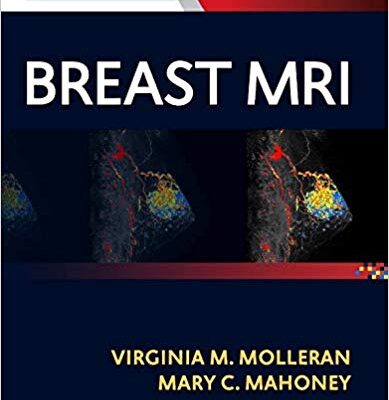 خرید و دانلود نسخه کامل کتاب Breast MRI E-Book