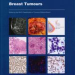 خرید و دانلود نسخه کامل کتاب Breast Tumours: WHO Classification of Tumours