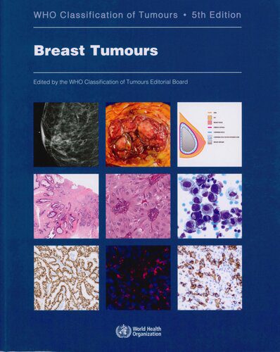 خرید و دانلود نسخه کامل کتاب Breast Tumours: WHO Classification of Tumours_68bb190fa1c4b.jpeg خرید و دانلود نسخه کامل کتاب Breast Tumours: WHO Classification of Tumours