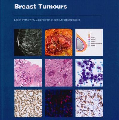 خرید و دانلود نسخه کامل کتاب Breast Tumours: WHO Classification of Tumours