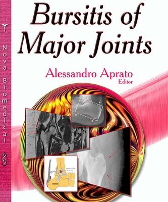 خرید و دانلود نسخه کامل کتاب Bursitis of Major Jointss