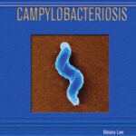 خرید و دانلود نسخه کامل کتاب Campylobacteriosis (Deadly Diseases and Epidemics)