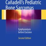 خرید و دانلود نسخه کامل کتاب Cañadell’s Pediatric Bone Sarcomas: Epiphysiolysis before Excision