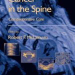 خرید و دانلود نسخه کامل کتاب Cancer in the Spine: Comprehensive Care