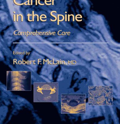 خرید و دانلود نسخه کامل کتاب Cancer in the Spine: Comprehensive Care