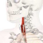 خرید و دانلود نسخه کامل کتاب Cancer of the Larynx: Current Concepts in the Treatment of the Neck (ORL)