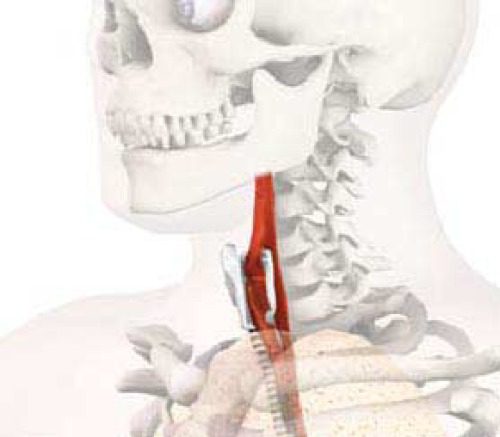 خرید و دانلود نسخه کامل کتاب Cancer of the Larynx: Current Concepts in the Treatment of the Neck (ORL)_68bb4f95b35ad.jpeg خرید و دانلود نسخه کامل کتاب Cancer of the Larynx: Current Concepts in the Treatment of the Neck (ORL)