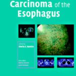 خرید و دانلود نسخه کامل کتاب Carcinoma of the Esophagus (Contemporary Issues in Cancer Imaging)