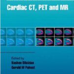 خرید و دانلود نسخه کامل کتاب Cardiac CT, PET and MR