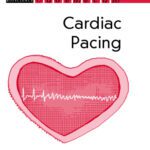 خرید و دانلود نسخه کامل کتاب Cardiac Pacing – Vademecum