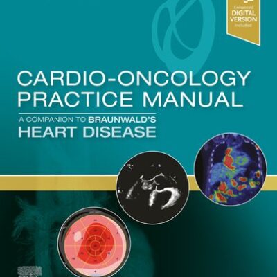 خرید و دانلود نسخه کامل کتاب Cardio-Oncology Practice Manual: A Companion to Braunwald’s Heart Disease