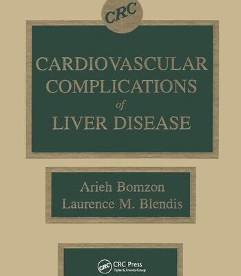 خرید و دانلود نسخه کامل کتاب Cardiovascular Complications of Liver Disease