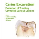 خرید و دانلود نسخه کامل کتاب Caries Excavation Evolution of Treating Cavitated Carious Lesions (Monographs in Oral Science, Vol. 27)