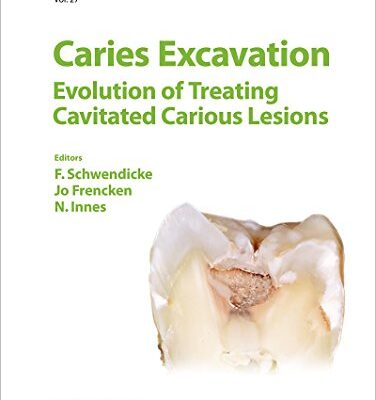 خرید و دانلود نسخه کامل کتاب Caries Excavation Evolution of Treating Cavitated Carious Lesions (Monographs in Oral Science, Vol. 27)