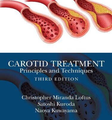 خرید و دانلود نسخه کامل کتاب Carotid Treatment: Principles and Techniques