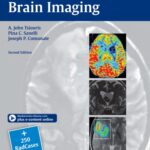 خرید و دانلود نسخه کامل کتاب Case-Based Brain Imaging