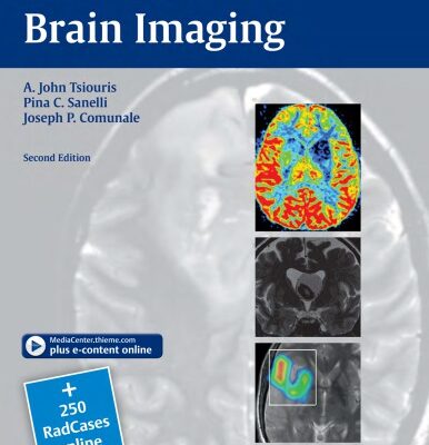 خرید و دانلود نسخه کامل کتاب Case-Based Brain Imaging